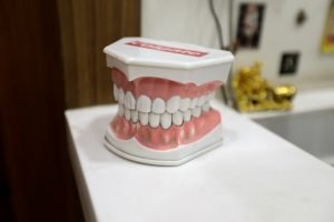 Teeth Cleaning Treatment in Kumbakonam