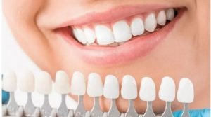 Cosmetic Dentistsry Treatment in Kumbakonam