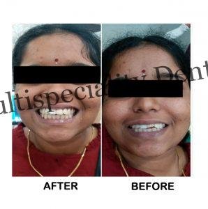 7 Benefits of Orthodontic Care at Banu Dental