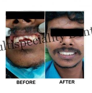Dentists in Mayiladuthurai