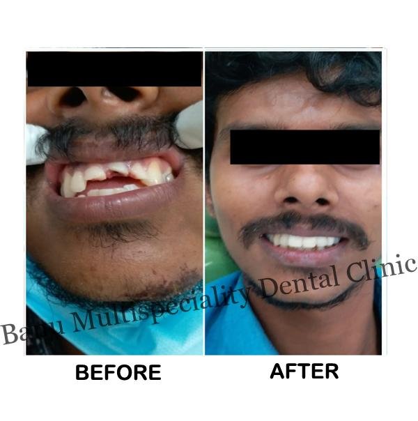 Dentists in Mayiladuthurai