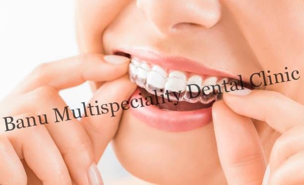 Can Teeth Cleaning Help Prevent Bad Breath?