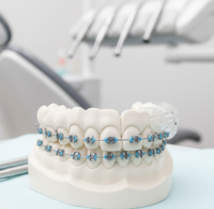 What Does a Cosmetic Dentist Do Before and After Treatment?
